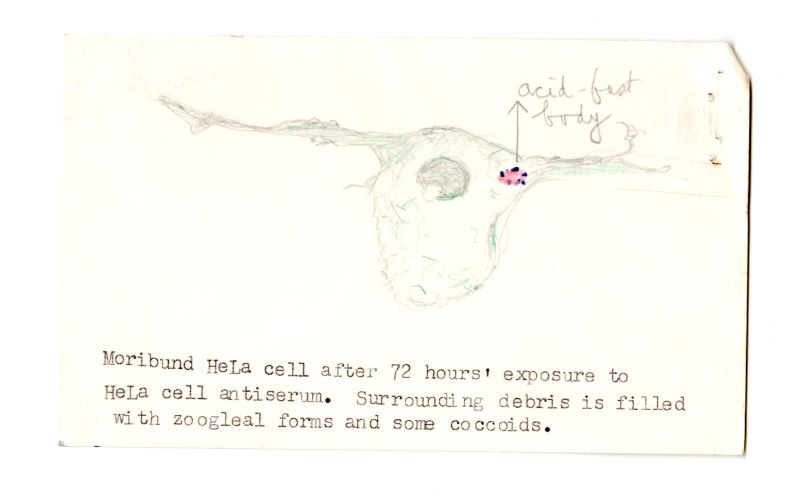 Drawing of a HeLa cell in a letter from Irene Diller to Florence Seibert, 1964